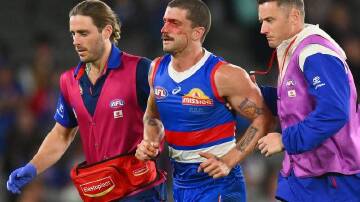 A bloodied Tom Liberatore is helped from the field late in the Bulldogs' loss to Hawthorn. (Morgan Hancock/AAP PHOTOS)